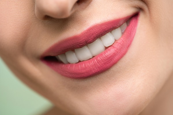 Wikend Smile, alta estética dental para conseguir la mejor sonrisa
